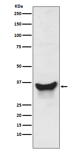 WB - BNIP3L Antibody AP91336